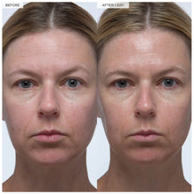 Load image into Gallery viewer, Plum Plump Hyaluronic Serum
